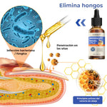 ELIMINA LOS HONGOS DE LAS UÑAS EN 5 DÍAS Y EVITA QUE APEREZCAN PARA SIEMPRE