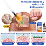 ELIMINA LOS HONGOS DE LAS UÑAS EN 5 DÍAS Y EVITA QUE APEREZCAN PARA SIEMPRE